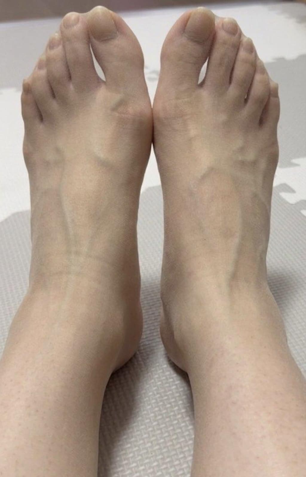 7/4