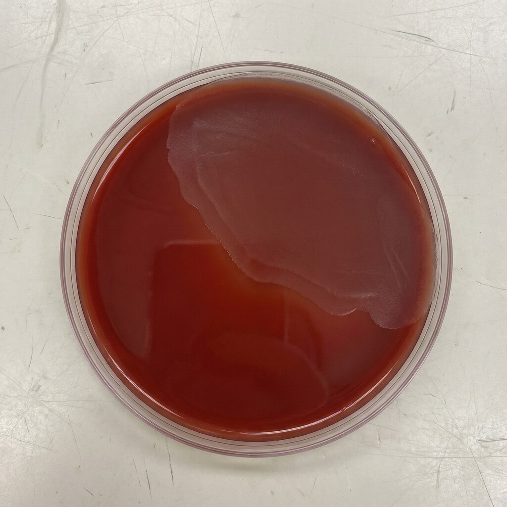 血液寒天培地上の破傷風菌（Clostridium tetani）観察写真