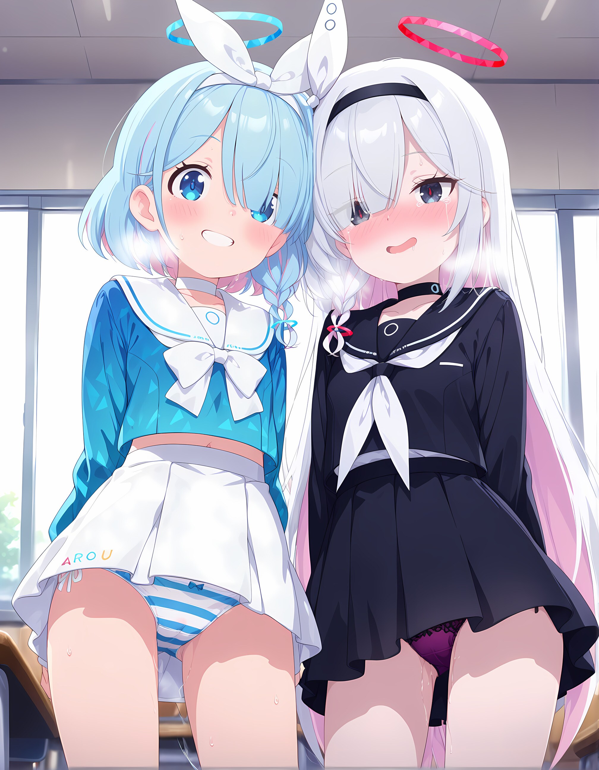 アロプラ