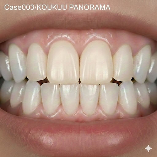 003：硬質レジン前装冠の欺瞞と二律背反 | の人気AIイラスト・グラビア